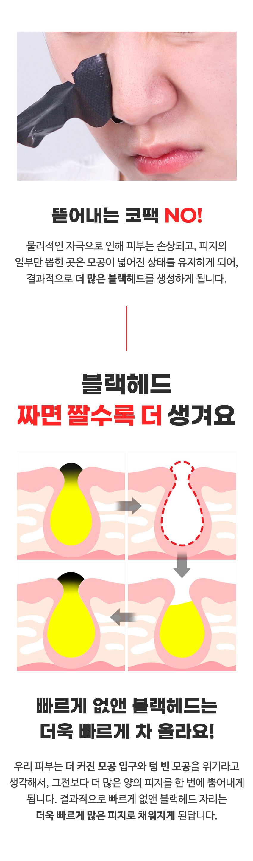 [한글-상세페이지]-[티암]-블랙헤드-아웃-시트_1_[리뉴얼]_04.jpg