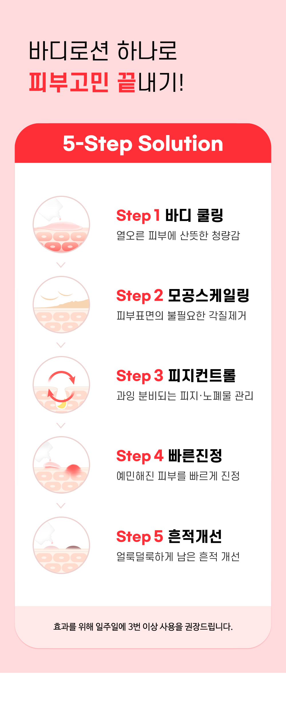 [한글-상세페이지]-[티암]-안티-블래미쉬-바디-로션_[리뉴얼]_완료_04.jpg
